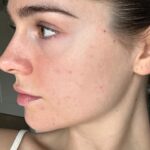 Skin Care Guide 2026: Healthy, Glowing & Flawless Skin Naturally