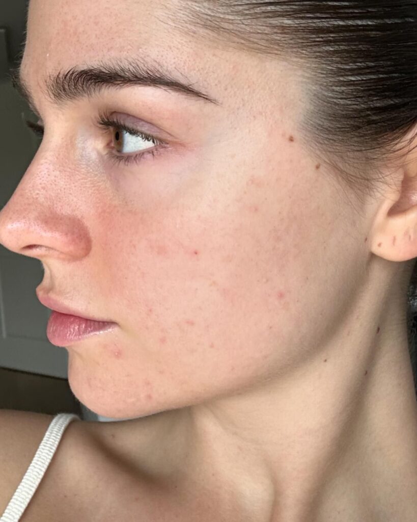 Skin Care Guide 2026: Healthy, Glowing & Flawless Skin Naturally