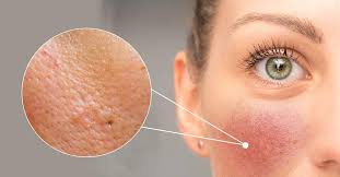 ✨ Skin Care Guide: Healthy, Glowing & Naturally Beautiful Skin