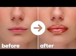 💋 Lip Care Guide: Soft, Pink & Naturally Beautiful Lips