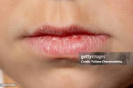 Beautiful Lips Care Guide: Soft, Smooth & Naturally Attractive Lips
